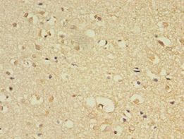 FLRT1 Antibody - Immunohistochemistry of paraffin-embedded human brain tissue using antibody at 1:100 dilution.  This image was taken for the unconjugated form of this product. Other forms have not been tested.