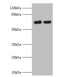FLRT1 Antibody - Western blot All lanes: FLRT1 antibody at 2µg/ml Lane 1: Mouse kidney tissue Lane 2: Hela whole cell lysate Secondary Goat polyclonal to rabbit IgG at 1/10000 dilution Predicted band size: 72 kDa Observed band size: 72 kDa