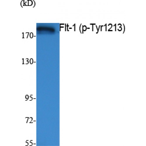 FLT1 / VEGFR1 Antibody - Western blot of Phospho-Flt-1 (Y1213) antibody