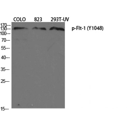 FLT1 / VEGFR1 Antibody - Western blot of Phospho-Flt-1 (Y1048) antibody