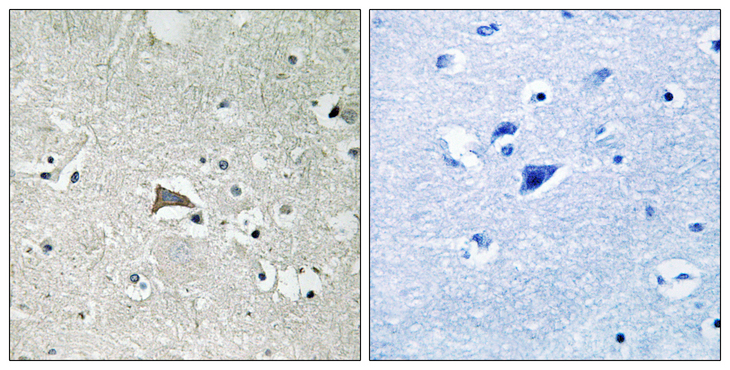 FLT1 / VEGFR1 Antibody - Immunohistochemistry analysis of paraffin-embedded human brain tissue, using VEGFR1 Antibody. The picture on the right is blocked with the synthesized peptide.