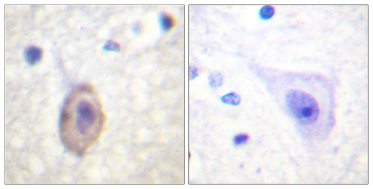 FLT1 / VEGFR1 Antibody - Immunohistochemistry analysis of paraffin-embedded human brain tissue, using VEGFR1 Antibody. The picture on the right is blocked with the synthesized peptide.