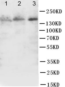 FLT1 / VEGFR1 Antibody - WB of FLKT1 / FLT-1 / VEGFR1 antibody. Lane 1: MCF-7 Cell Lysate. Lane 2: SGC Cell Lysate. Lane 3: M231 Cell Lysate.