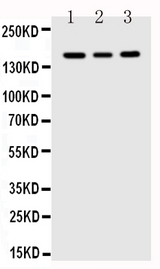 FLT1 / VEGFR1 Antibody - Anti-FLT1 antibody, Western blotting Lane 1: MCF-7 Cell LysateLane 2: SGC Cell LysateLane 3: MM231 Cell Lysate