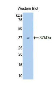 FLT1 / VEGFR1 Antibody - Western blot of recombinant FLKT1 / FLT-1 / VEGFR1.  This image was taken for the unconjugated form of this product. Other forms have not been tested.