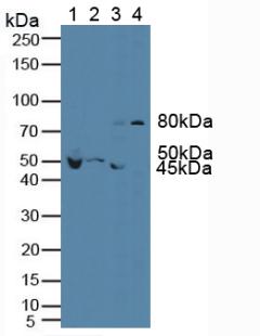 FLT1 / VEGFR1 Antibody - Western Blot; Sample: Lane1: Mouse Brain Tissue; Lane2: Mouse Cerebellum Tissue; Lane3: Rat Brain Tissue; Lane4: Human Hela Cells.