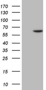 FLT1 / VEGFR1 Antibody - HEK293T cells were transfected with the pCMV6-ENTRY control (Left lane) or pCMV6-ENTRY FLT1 (Right lane) cDNA for 48 hrs and lysed. Equivalent amounts of cell lysates (5 ug per lane) were separated by SDS-PAGE and immunoblotted with anti-FLT1.