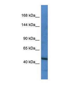 FLT1 / VEGFR1 Antibody - Western blot of Human HepG2. FLT1 antibody dilution 1.0 ug/ml.  This image was taken for the unconjugated form of this product. Other forms have not been tested.