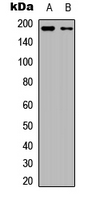 FLT1 / VEGFR1 Antibody - Western blot analysis of VEGFR1 expression in A431 (A); HCT116 (B) whole cell lysates.