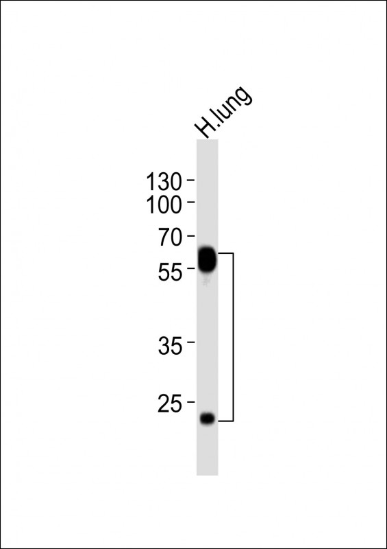 FLT1 / VEGFR1 Antibody - Anti-FLT1 Antibody at 1:2000 dilution + human lung lysates Lysates/proteins at 20 ug per lane. Secondary Goat Anti-Rabbit IgG, (H+L), Peroxidase conjugated at 1/10000 dilution Predicted band size : 151 kD Blocking/Dilution buffer: 5% NFDM/TBST.