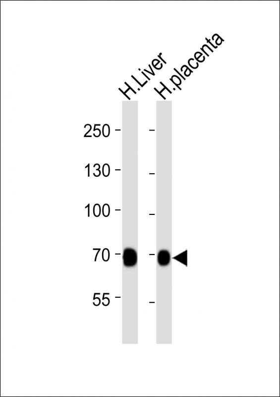 FLT1 / VEGFR1 Antibody - All lanes : Anti-FLT1 Antibody at 1:2000 dilution Lane 1: human Liver lysates Lane 2: human placenta lysates Lysates/proteins at 20 ug per lane. Secondary Goat Anti-Rabbit IgG, (H+L), Peroxidase conjugated at 1/10000 dilution Predicted band size : 151 kDa Blocking/Dilution buffer: 5% NFDM/TBST.