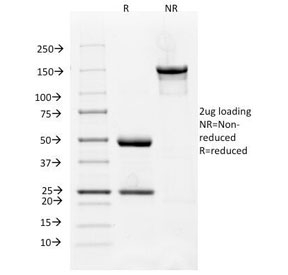 FLT1 / VEGFR1 Antibody - SDS-PAGE Analysis of Purified, BSA-Free VEGFR1 Antibody (clone FLT1/658). Confirmation of Integrity and Purity of the Antibody.