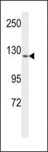 FLT1 / VEGFR1 Antibody - Western blot of VGFR1 Antibody in MCF-7 cell line lysates (35 ug/lane). VGFR1 (arrow) was detected using the purified antibody.