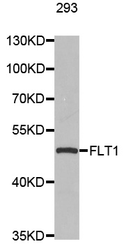 FLT1 / VEGFR1 Antibody - Western blot analysis of extracts of 293 cells.
