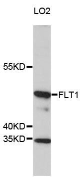 FLT1 / VEGFR1 Antibody - Western blot analysis of extracts of LO2 cells, using FLT1 antibody at 1:1000 dilution. The secondary antibody used was an HRP Goat Anti-Rabbit IgG (H+L) at 1:10000 dilution. Lysates were loaded 25ug per lane and 3% nonfat dry milk in TBST was used for blocking. An ECL Kit was used for detection and the exposure time was 10s.