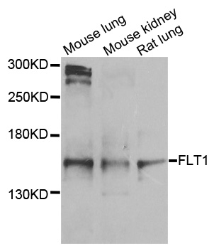 FLT1 / VEGFR1 Antibody - Western blot analysis of extracts of various cell lines, using FLT1 antibody at 1:1000 dilution. The secondary antibody used was an HRP Goat Anti-Rabbit IgG (H+L) at 1:10000 dilution. Lysates were loaded 25ug per lane and 3% nonfat dry milk in TBST was used for blocking. An ECL Kit was used for detection and the exposure time was 90s.