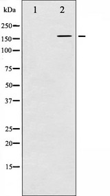 FLT1 / VEGFR1 Antibody - Western blot analysis of VEGFR1 expression in HeLa whole cells lysates. The lane on the left is treated with the antigen-specific peptide.