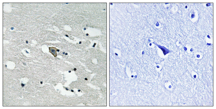 FLT1 / VEGFR1 Antibody - Immunohistochemistry analysis of paraffin-embedded human brain, using VEGFR1 (Phospho-Tyr1048) Antibody. The picture on the right is blocked with the phospho peptide.