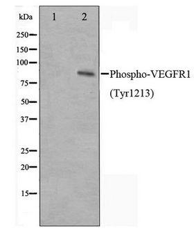 FLT1 / VEGFR1 Antibody - Western blot of VEGFR1 phosphorylation expression in UV treated HeLa whole cell lysates,The lane on the left is treated with the antigen-specific peptide.