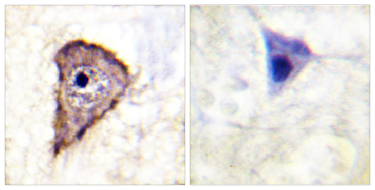 FLT1 / VEGFR1 Antibody - Immunohistochemistry analysis of paraffin-embedded human brain, using VEGFR1 (Phospho-Tyr1333) Antibody. The picture on the right is blocked with the phospho peptide.