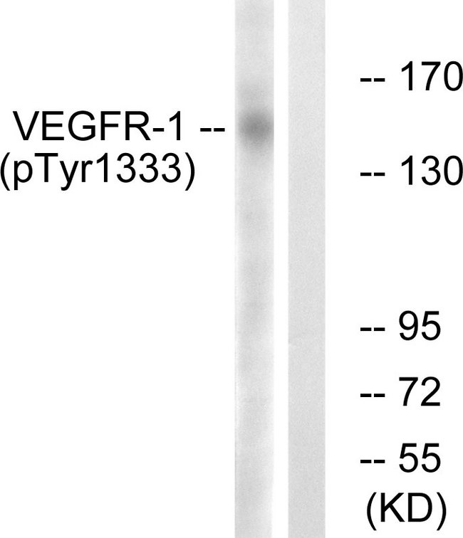 FLT1 / VEGFR1 Antibody - Western blot analysis of lysates from K562 cells treated with etoposide 25uM 24h, using VEGFR1 (Phospho-Tyr1333) Antibody. The lane on the right is blocked with the phospho peptide.