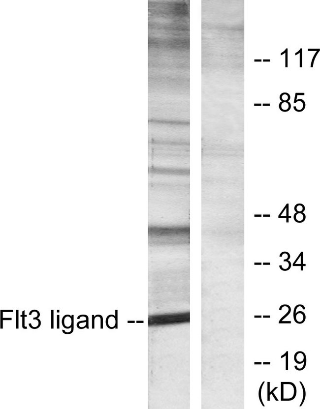 FLT3LG / Flt3 Ligand Antibody - Western blot analysis of lysates from Jurkat cells, using Flt3 ligand Antibody. The lane on the right is blocked with the synthesized peptide.