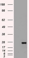 FLT3LG / Flt3 Ligand Antibody - HEK293T cells were transfected with the pCMV6-ENTRY control (Left lane) or pCMV6-ENTRY FLT3LG (Right lane) cDNA for 48 hrs and lysed. Equivalent amounts of cell lysates (5 ug per lane) were separated by SDS-PAGE and immunoblotted with anti-FLT3LG.