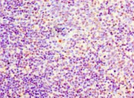 FLT3LG / Flt3 Ligand Antibody - Immunohistochemistry of paraffin-embedded human tonsil tissue using antibody at 1:100 dilution.  This image was taken for the unconjugated form of this product. Other forms have not been tested.