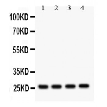FLT3LG / Flt3 Ligand Antibody - Flt3 ligand antibody Western blot. All lanes: Anti Flt3 ligand at 0.5 ug/ml. Lane 1: Rat Brain Tissue Lysate at 50 ug. Lane 2: Rat Spleen Tissue Lysate at 50 ug. Lane 3: Rat Kidney Tissue Lysate at 50 ug. Lane 4: SMMC Whole Cell Lysate at 40 ug. Predicted band size: 26 kD. Observed band size: 26 kD.