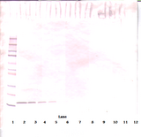 FLT3LG / Flt3 Ligand Antibody - Anti-Human Flt3-Ligand Western Blot Reduced