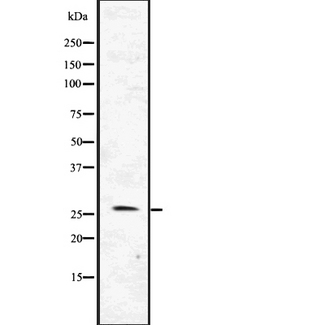 FLT3LG / Flt3 Ligand Antibody - Western blot analysis of FLT3LG using HepG2 whole lysates.