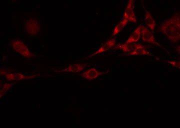 FLT3LG / Flt3 Ligand Antibody - Staining HeLa cells by IF/ICC. The samples were fixed with PFA and permeabilized in 0.1% Triton X-100, then blocked in 10% serum for 45 min at 25°C. The primary antibody was diluted at 1:200 and incubated with the sample for 1 hour at 37°C. An Alexa Fluor 594 conjugated goat anti-rabbit IgG (H+L) Ab, diluted at 1/600, was used as the secondary antibody.