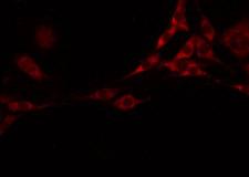 FLT3LG / Flt3 Ligand Antibody - Staining HeLa cells by IF/ICC. The samples were fixed with PFA and permeabilized in 0.1% Triton X-100, then blocked in 10% serum for 45 min at 25°C. The primary antibody was diluted at 1:200 and incubated with the sample for 1 hour at 37°C. An Alexa Fluor 594 conjugated goat anti-rabbit IgG (H+L) Ab, diluted at 1/600, was used as the secondary antibody.