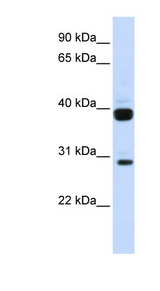FLT3LG / Flt3 Ligand Antibody - FLT3LG / Flt3 Ligand antibody Western blot of Fetal Muscle lysate. This image was taken for the unconjugated form of this product. Other forms have not been tested.