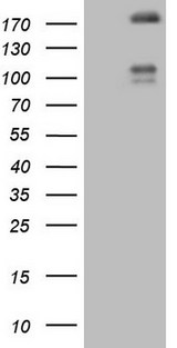FLT4 / VEGFR3 Antibody - HEK293T cells were transfected with the pCMV6-ENTRY control (Left lane) or pCMV6-ENTRY FLT4 (Right lane) cDNA for 48 hrs and lysed. Equivalent amounts of cell lysates (5 ug per lane) were separated by SDS-PAGE and immunoblotted with anti-FLT4.