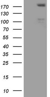 FLT4 / VEGFR3 Antibody - HEK293T cells were transfected with the pCMV6-ENTRY control (Left lane) or pCMV6-ENTRY FLT4 (Right lane) cDNA for 48 hrs and lysed. Equivalent amounts of cell lysates (5 ug per lane) were separated by SDS-PAGE and immunoblotted with anti-FLT4.