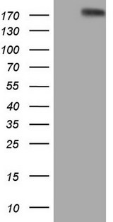 FLT4 / VEGFR3 Antibody - HEK293T cells were transfected with the pCMV6-ENTRY control. (Left lane) or pCMV6-ENTRY FLT4. (Right lane) cDNA for 48 hrs and lysed. Equivalent amounts of cell lysates. (5 ug per lane) were separated by SDS-PAGE and immunoblotted with anti-FLT4.