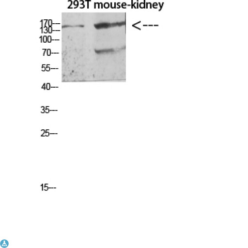 FLT4 / VEGFR3 Antibody - Western blot analysis of 293T and mouse kidney lysate, antibody was diluted at 500. Secondary antibody was diluted at 1:20000.