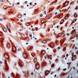 FLT4 / VEGFR3 Antibody - Human placenta stained with Anti-Flt-4 antibody