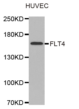 FLT4 / VEGFR3 Antibody - Western blot analysis of extracts of HUVEC cells.