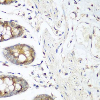 FLT4 / VEGFR3 Antibody - Immunohistochemistry of paraffin-embedded human colon tissue.