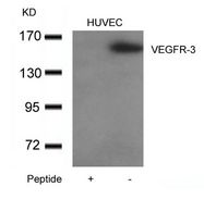 FLT4 / VEGFR3 Antibody - Western blot of extracts from HUVEC cells using VEGFR-3 Antibody (right) and the same antibody preincubated with blocking peptide