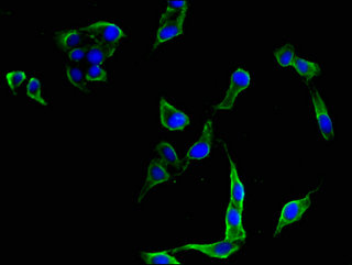 FLT4 / VEGFR3 Antibody - Immunofluorescent analysis of Hela cells using FLT4 Antibody at a dilution of 1:100 and Alexa Fluor 488-congugated AffiniPure Goat Anti-Rabbit IgG(H+L)
