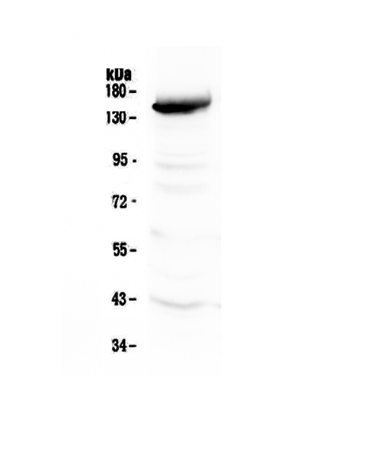 FLT4 / VEGFR3 Antibody - Western blot - Anti-VEGF Receptor 3 Picoband antibody