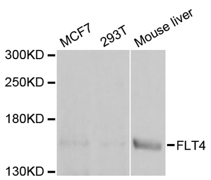 FLT4 / VEGFR3 Antibody - Western blot analysis of extracts of various cell lines, using FLT4 antibody at 1:1000 dilution. The secondary antibody used was an HRP Goat Anti-Rabbit IgG (H+L) at 1:10000 dilution. Lysates were loaded 25ug per lane and 3% nonfat dry milk in TBST was used for blocking. An ECL Kit was used for detection and the exposure time was 60s.