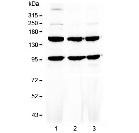 FLT4 / VEGFR3 Antibody - Western blot testing of human 1) HeLa, 2) MCF7 and 3) HepG2 cell lysate with VEGFR3 antibody at 0.5ug/ml. Predicted molecular weight ~153 kDa (long), ~147 kDa (short) and ~93 kDa (sVegfr3).
