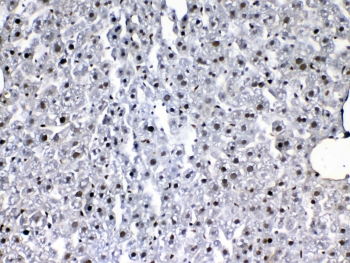 FLT4 / VEGFR3 Antibody - IHC testing of FFPE mouse liver tissue with VEGFR3 antibody at 1ug/ml. Required HIER: steam section in pH6 citrate buffer for 20 min and allow to cool prior to testing.