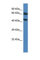 FLVCR / FLVCR1 Antibody - FLVCR1 / FLVCR antibody Western blot of Mouse Brain lysate. Antibody concentration 1 ug/ml.  This image was taken for the unconjugated form of this product. Other forms have not been tested.