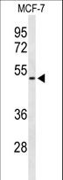FLVCR2 Antibody - Western blot of FLVC2 Antibody in MCF-7 cell line lysates (35 ug/lane). FLVC2 (arrow) was detected using the purified antibody.