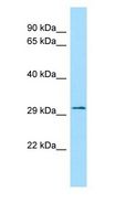 FLVCR2 Antibody - FLVCR2 antibody Western Blot of HCT15.  This image was taken for the unconjugated form of this product. Other forms have not been tested.